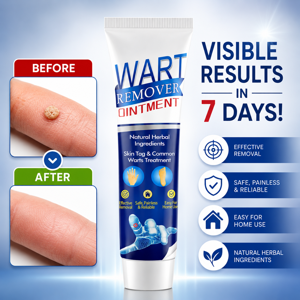 Wart Remover Cream