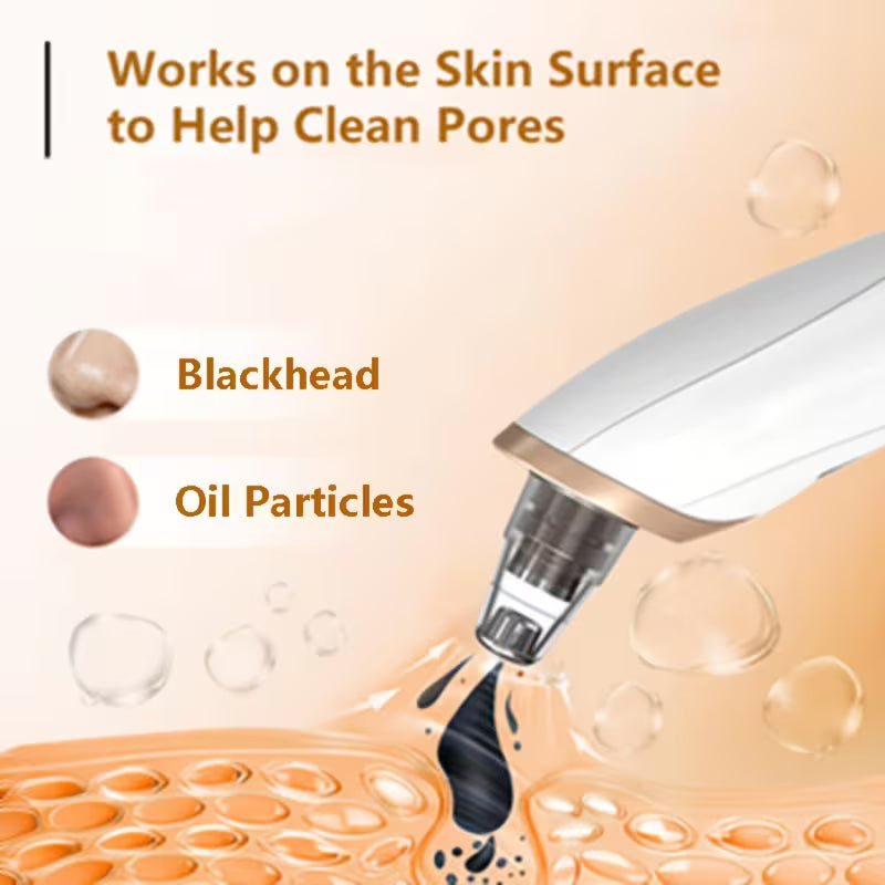 Blackhead Remover ✨50% OFF SALEE⚡