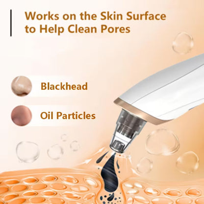 Blackhead Remover ✨50% OFF SALEE⚡