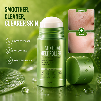 Blackhead Melt Roller ✨BUY 1 GET 1 FREE💚